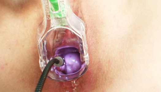 Perverse red-haired granny Zita squirts during gynecologist appointment porn pics