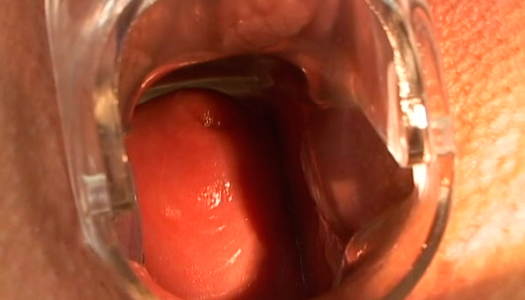 Brunette spreads legs wide and gets pussy lips stretched with vaginal speculum porn pics