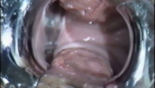 Insanely horny gynecologist inserts speculum into his patient's pussy porn pics