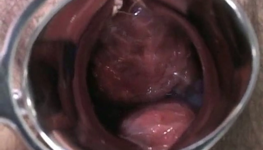 Pregnant Japanese lady is examined and sucks doctor's lollicock porn pics